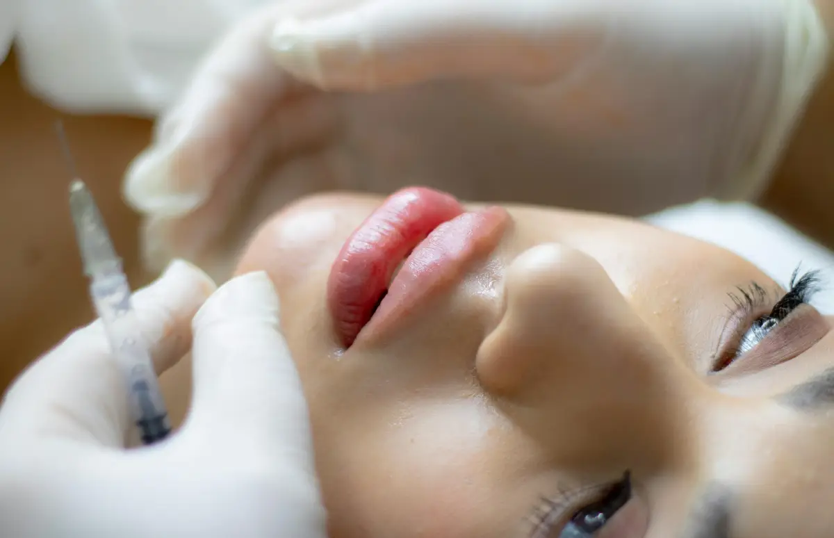 microneedling vs fillers