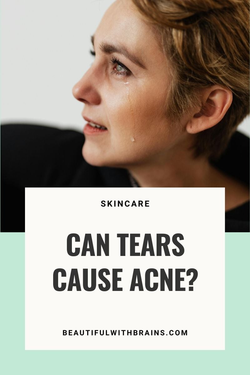 Can Tears Cause Acne?