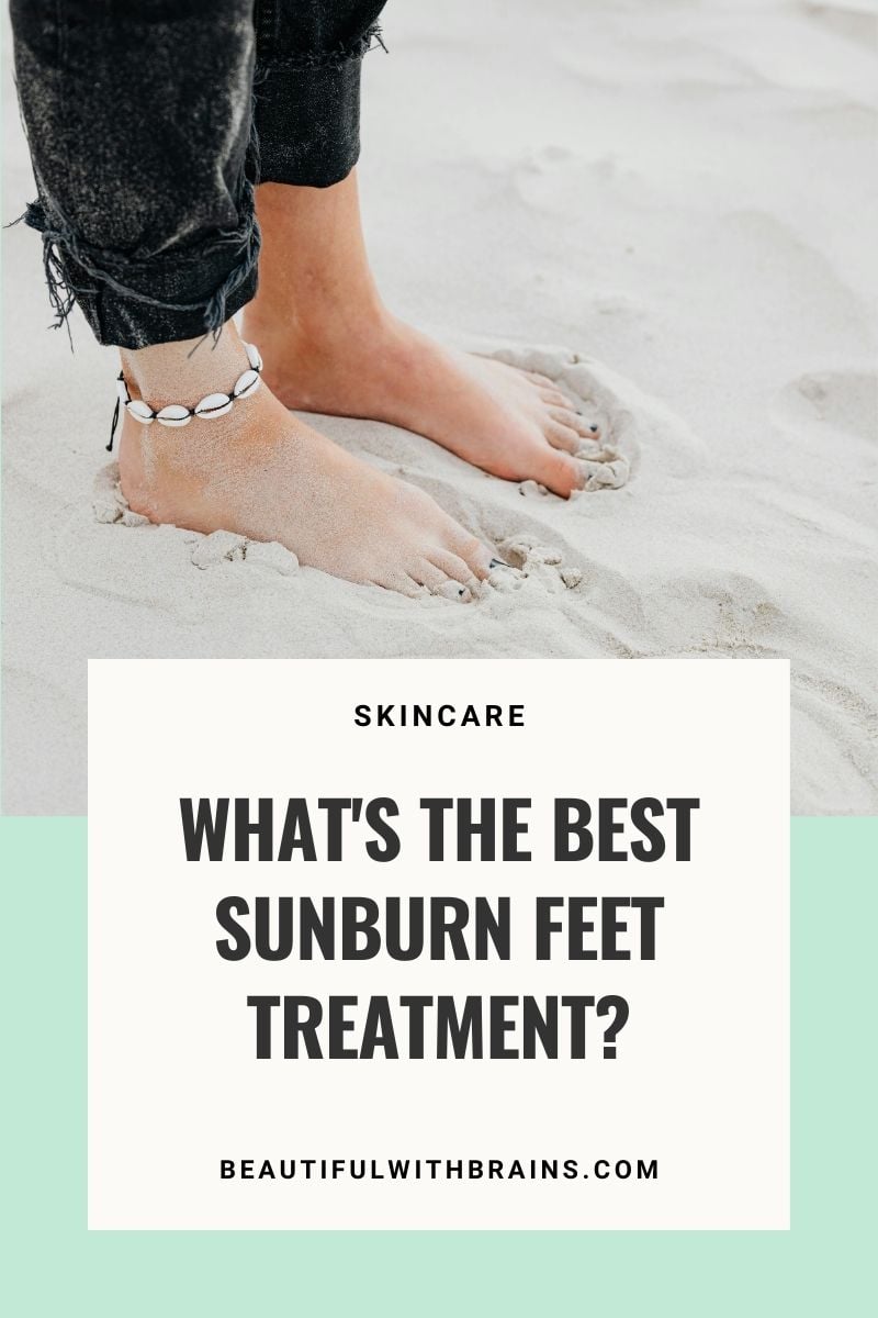 sunburn feet treatment