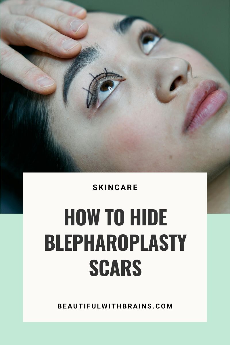 How To Hide Blepharoplasty Scars