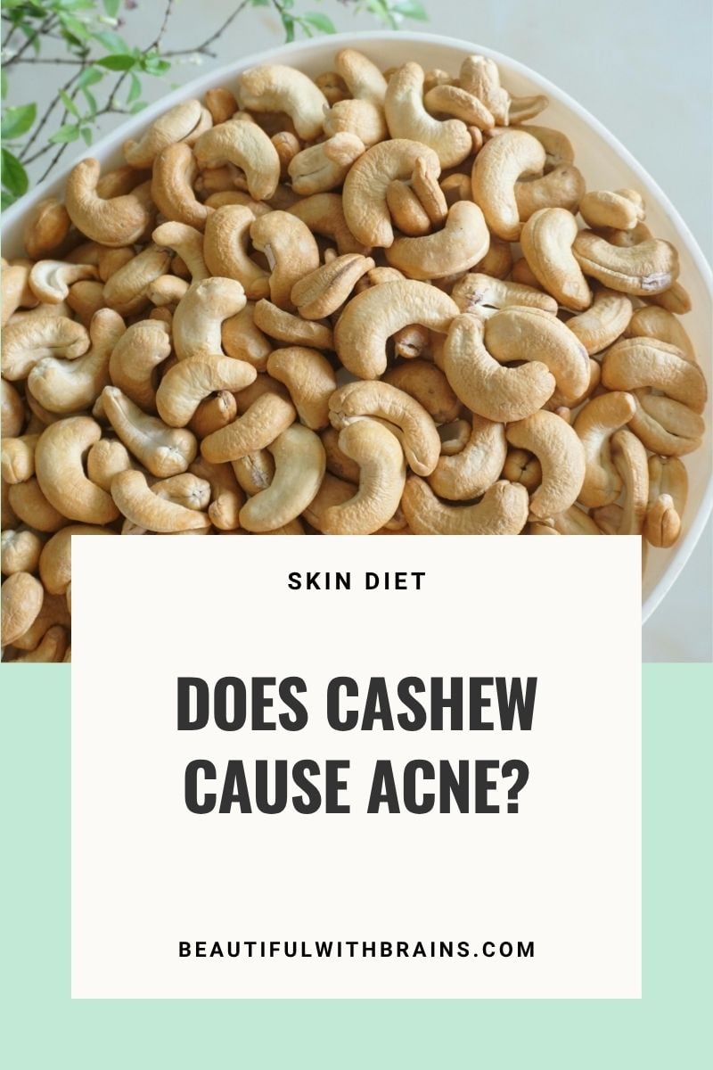Does Cashew Cause Acne?