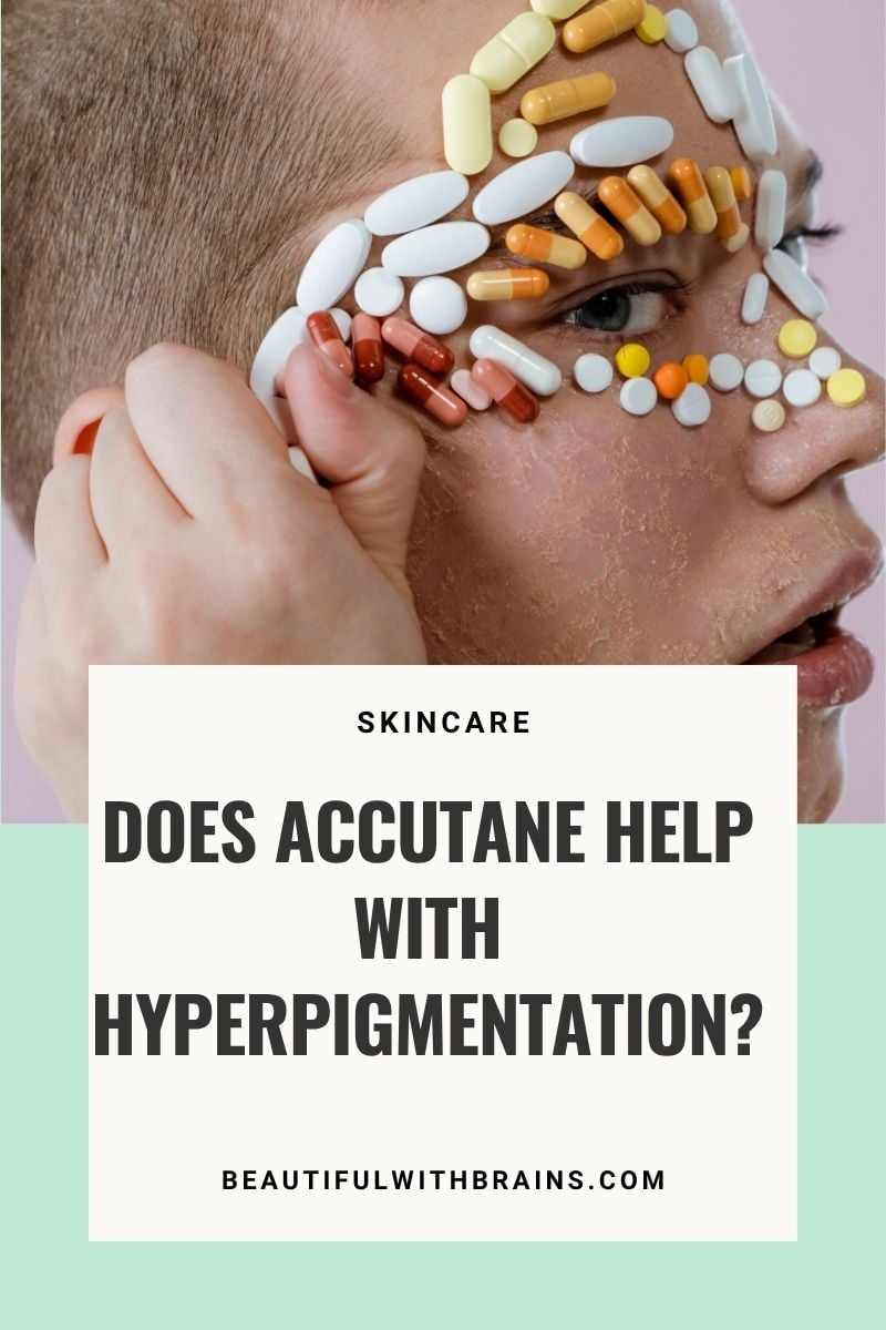 Does Accutane Help With Hyperpigmentation