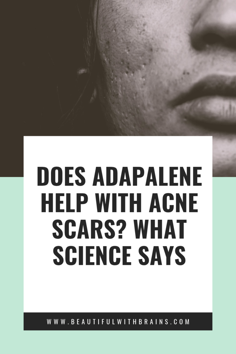 Does Adapalene Help With Acne Scars?